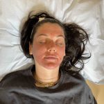Platelet-rich-plasma Skin Pen 3 Platelet rich plasma Skin Pen 3 | Well House - Wellness and Aesthetic Services
