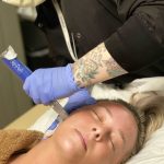 Platelet-rich-plasma Skin Pen 4 Platelet rich plasma Skin Pen 4 | Well House - Wellness and Aesthetic Services