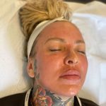 Platelet-rich-plasma Skin Pen 6 Platelet rich plasma Skin Pen 6 | Well House - Wellness and Aesthetic Services